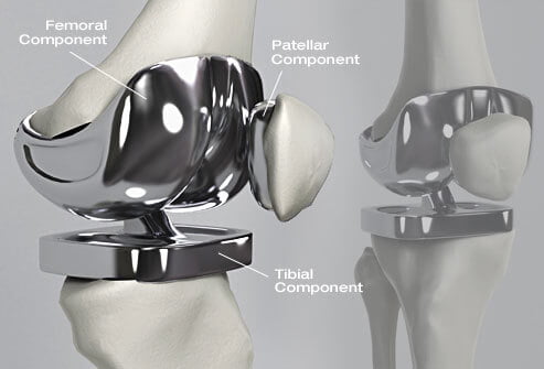 Knee Pain Treatment in Nashik