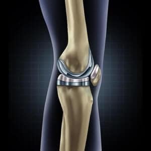 Knee Specialist in Nashik